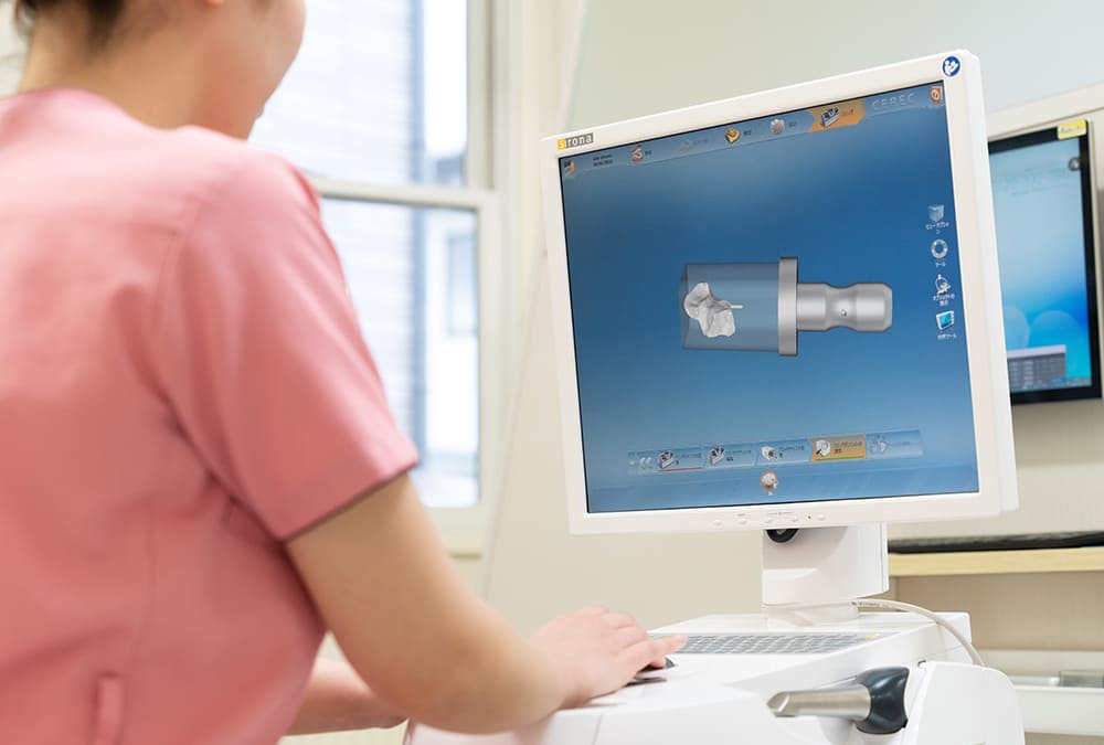 CAD/CAM(セレック)