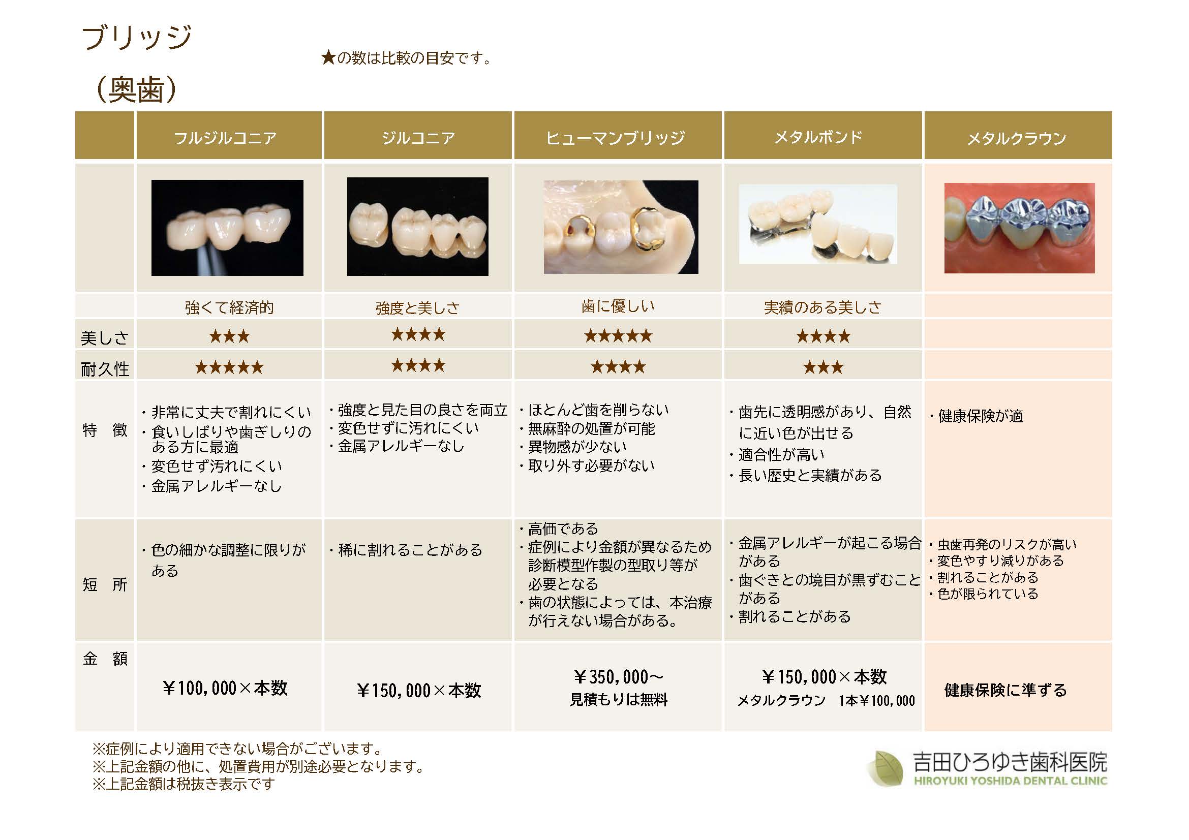ブリッジ奥歯料金表